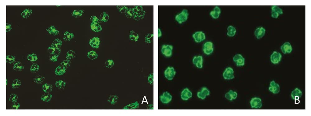 Beispiele für positive Fluoreszenzmuster: c-ANCA und p-ANCA.