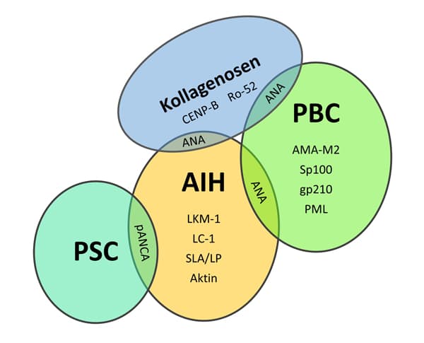 Schematische Darstellung überlappender Autoimmunerkrankungen der Leber: AIH, PBC, PSC und Kollagenosen mit zugehörigen Autoantikörpern.