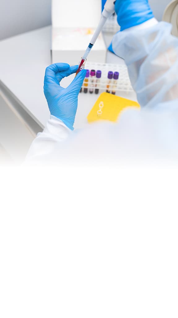 Nahaufnahme von Händen eines Laboranten, der gerade mit einer Pipette Blut aus einem Blutröhrchen entnimmt